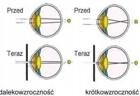 Ajurwedyjskie Okulary z dziurkami LECZĄCE WZROK oprawki korekcyjne