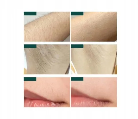 DEPILATOR IPL DO WŁOSÓW CIAŁA LASEROWY BIKINI NÓG DEPILACJA BEZBOLESNY