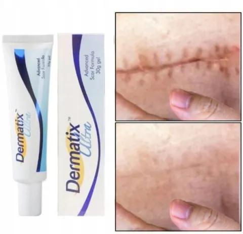 Dermatix Ultra Silikonowy Żel Do Leczenia i Zapobiegania Blizn 15g